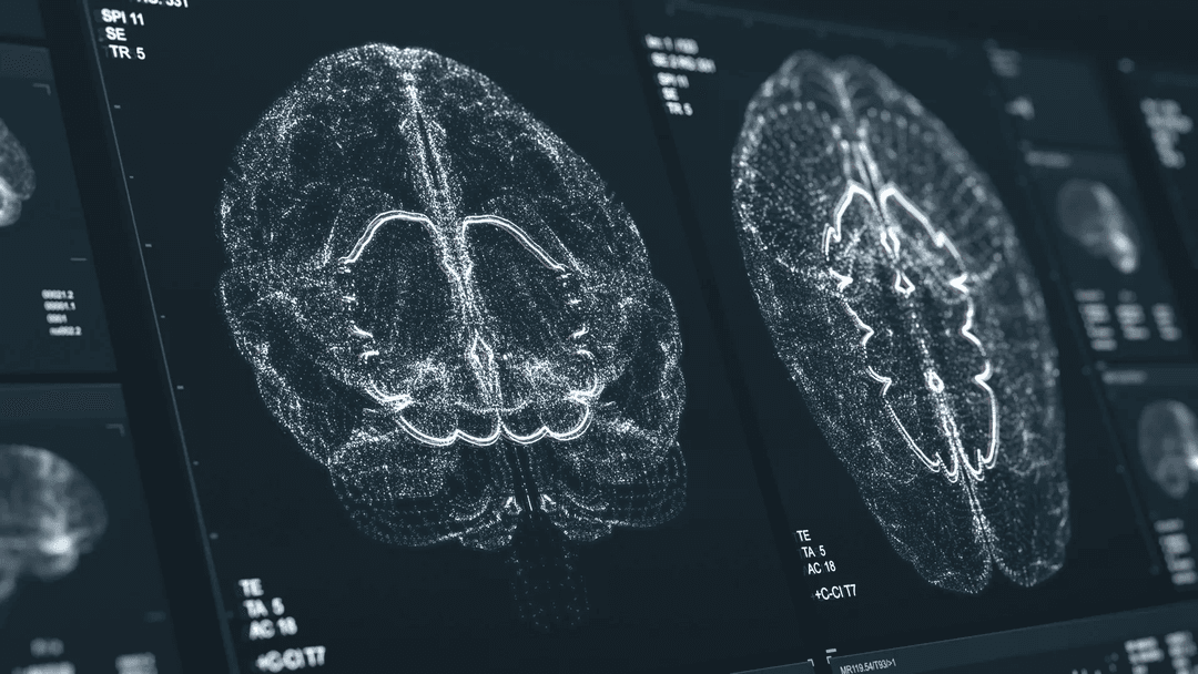 AI-Driven Diagnosis of Neurological Disorders